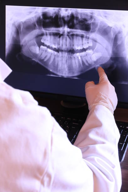 Best Broken or Chipped Tooth Repair in Spencerport, NY
