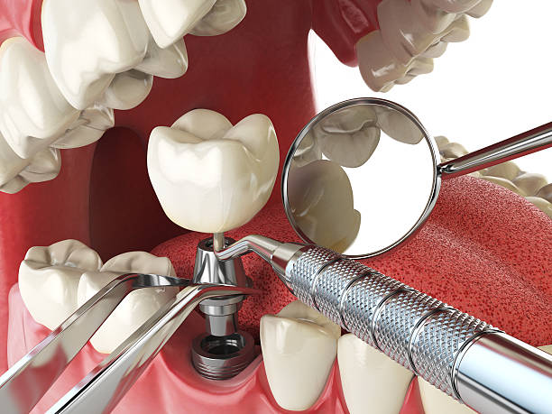 Best Walk-In Emergency Dental Services in Spencerport, NY