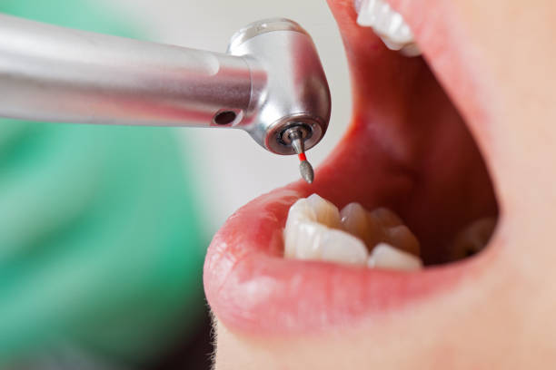 Best Emergency Treatment for Oral Infections in Spencerport, NY